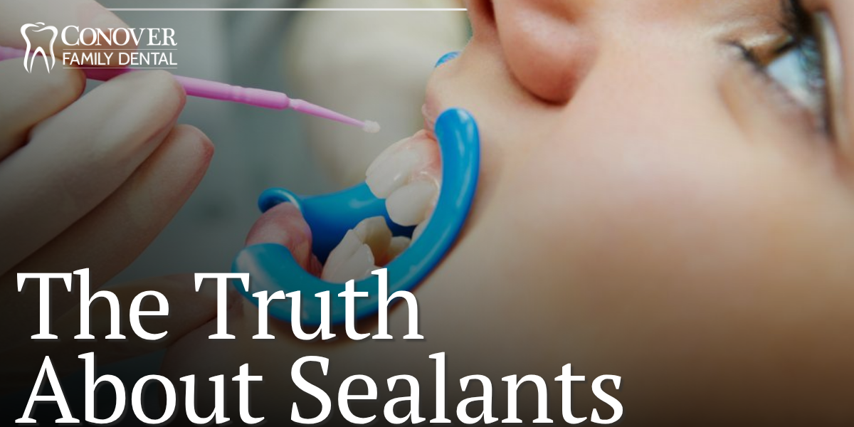 The Truth About Sealants