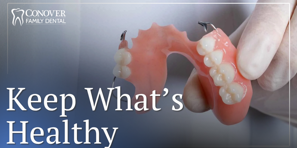 partial dentures