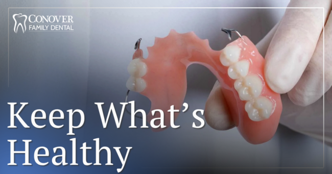 partial dentures