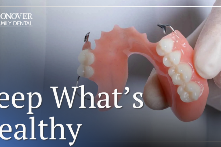 partial dentures